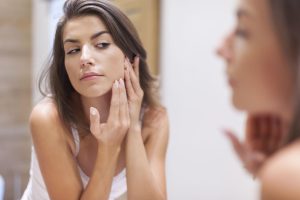 common areas to get acne