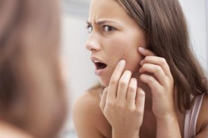 common skin issue