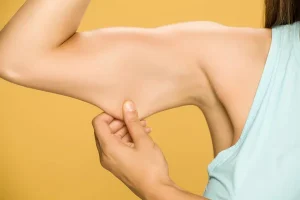 UNDERARM FAT