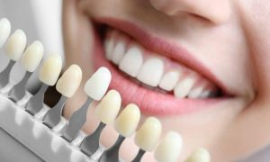 Dental Health